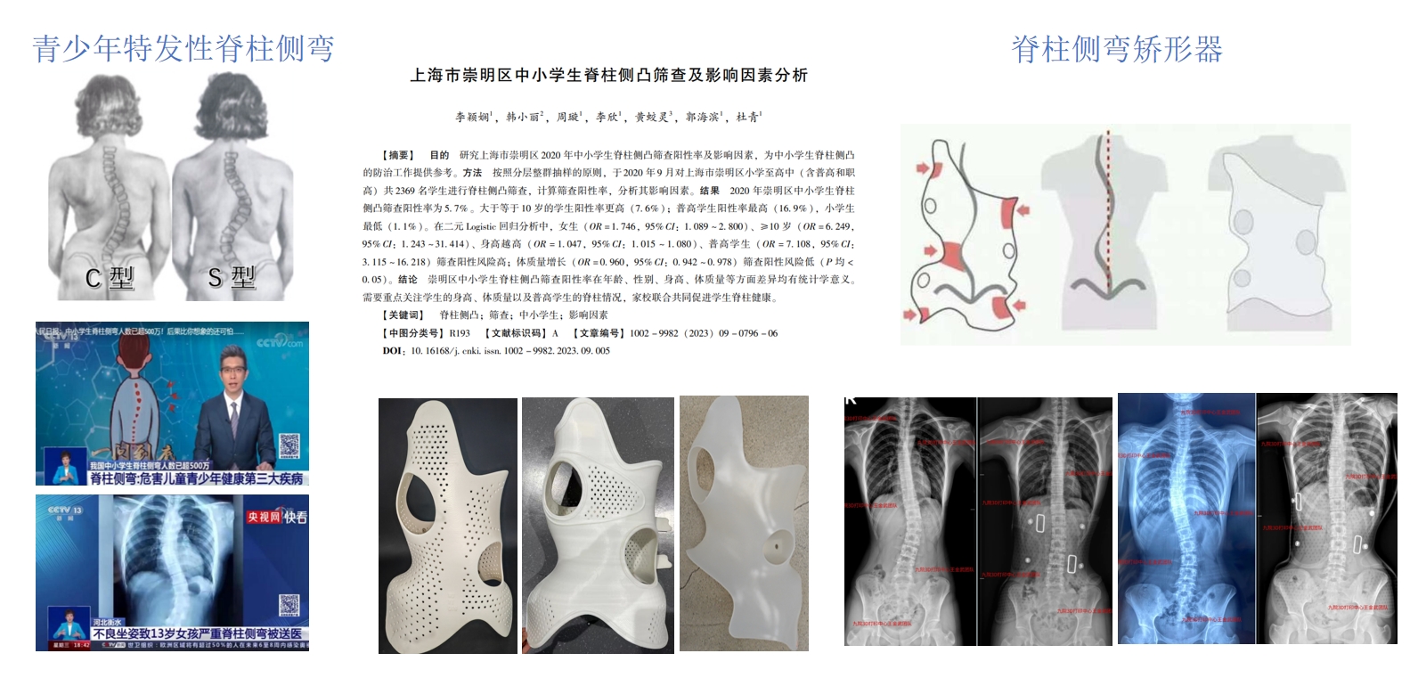 肝胆脾胰展示图