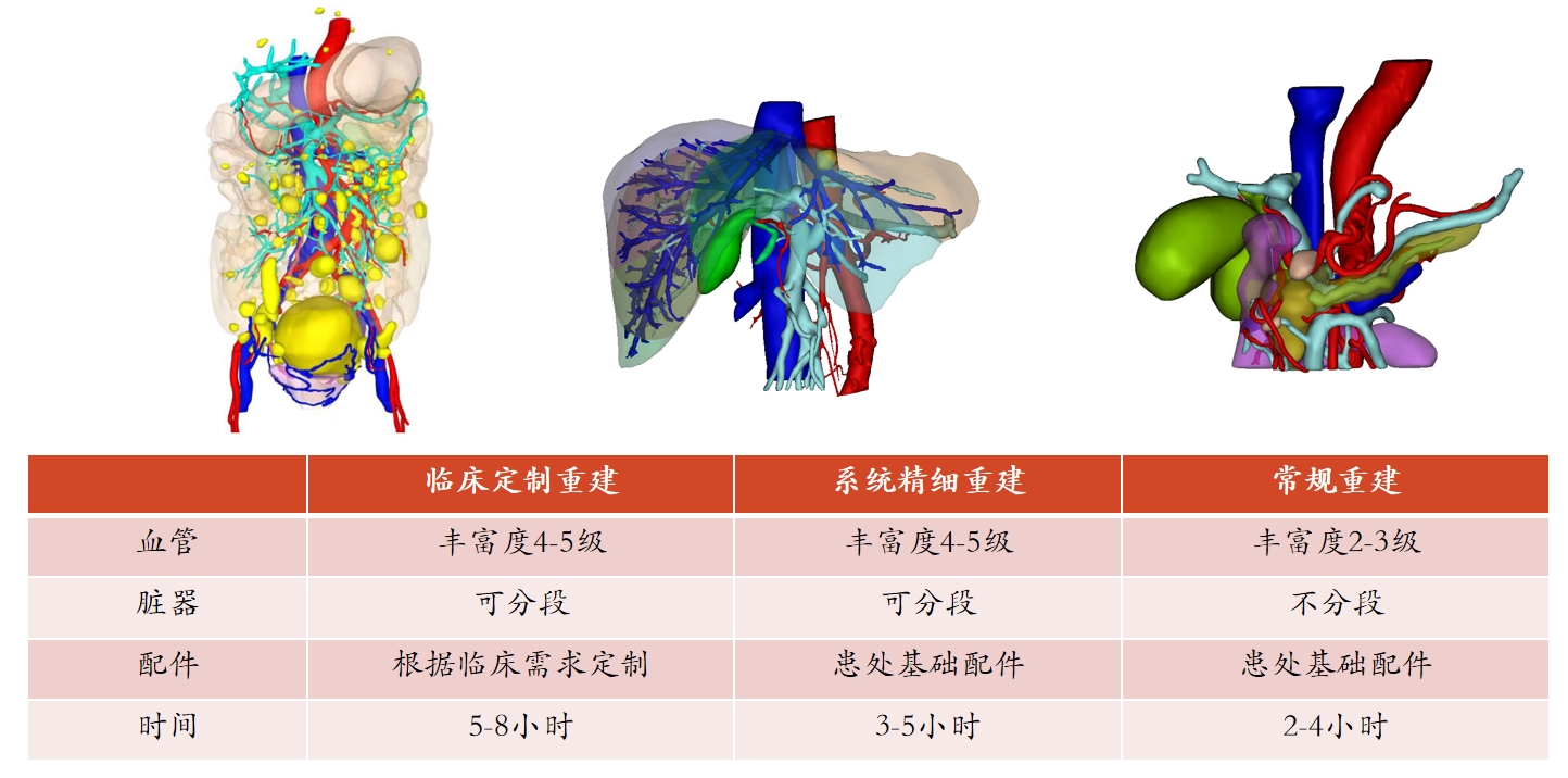 肝胆脾胰展示图